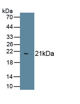 Polyclonal Antibody to Hedgehog Homolog, Indian (IHH)