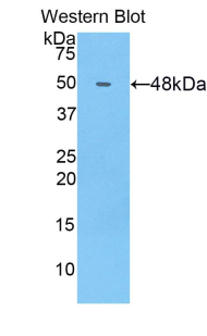 Polyclonal Antibody to Collagen Type XIV (COL14)