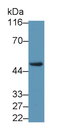 Polyclonal Antibody to Liver X Receptor Beta (LXRb)