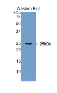 Polyclonal Antibody to Fibulin 2 (FBLN2)