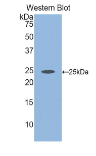 Polyclonal Antibody to Fibulin 2 (FBLN2)