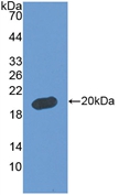 Polyclonal Antibody to Fibulin 5 (FBLN5)