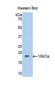 Polyclonal Antibody to Fibulin 5 (FBLN5)