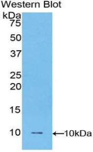 Polyclonal Antibody to Fibulin 5 (FBLN5)