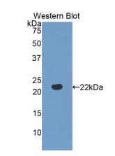 Polyclonal Antibody to Fibulin 5 (FBLN5)