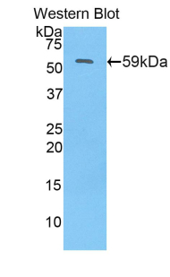 Polyclonal Antibody to N-Acetyl Alpha-D-Glucosaminidase (NAGLU)