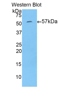 Polyclonal Antibody to N-Acetyl Alpha-D-Glucosaminidase (NAGLU)