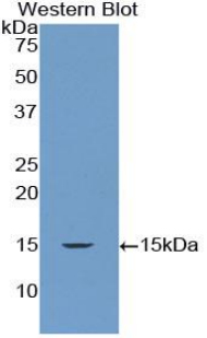 Polyclonal Antibody to Ribonuclease III, Nuclear (RNASEN)