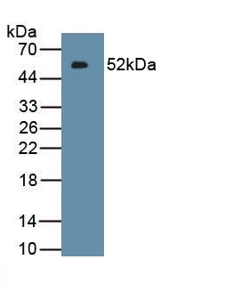 Polyclonal Antibody to Interferon Kappa (IFNk)