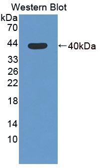 Polyclonal Antibody to Mannosyl Oligosaccharide Glucosidase (MOGS)