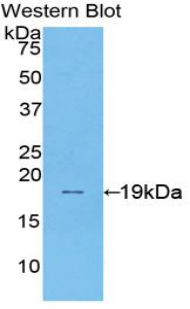 Polyclonal Antibody to Sucrase Isomaltase (SI)