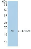 Polyclonal Antibody to Ribonuclease A7 (RNASE7)