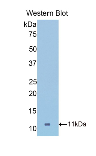 Polyclonal Antibody to Collagen Type II Alpha 1 (COL2a1)