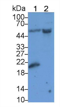 Polyclonal Antibody to Sjogren Syndrome Antigen B (SSB)