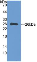 Polyclonal Antibody to Epstein Barr Virus Induced Protein 3 (EBI3)