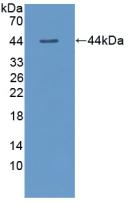 Polyclonal Antibody to Thyroid Stimulating Hormone Beta (TSHb)