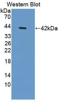 Polyclonal Antibody to Prothymosin Alpha (PTMa)