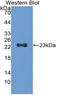 Polyclonal Antibody to Troponin I Type 1, Slow Skeletal (TNNI1)