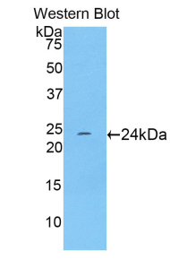 Polyclonal Antibody to Troponin I Type 1, Slow Skeletal (TNNI1)