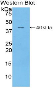 Polyclonal Antibody to Troponin T Type 1, Slow Skeletal (TNNT1)