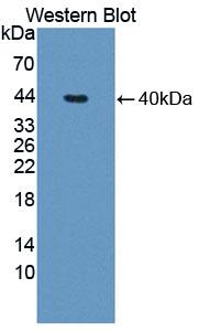 Polyclonal Antibody to Troponin T Type 1, Slow Skeletal (TNNT1)