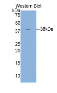 Polyclonal Antibody to Troponin T Type 2, Cardiac (TNNT2)