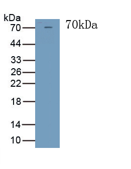 Polyclonal Antibody to Troponin T Type 2, Cardiac (TNNT2)