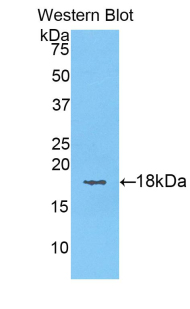 Polyclonal Antibody to Keratin 6A (KRT6A)