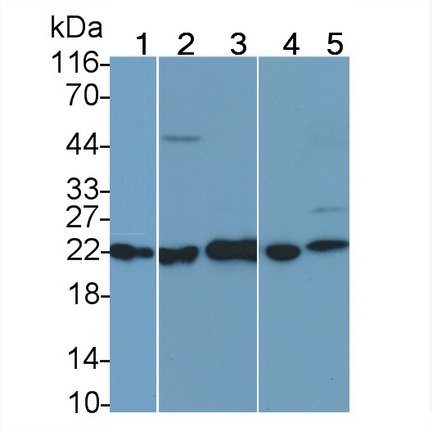 Polyclonal Antibody to Ferritin, Mitochondrial (FTMT)