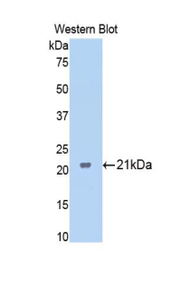 Polyclonal Antibody to Ferritin, Mitochondrial (FTMT)