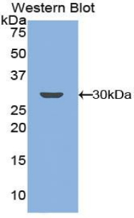 Polyclonal Antibody to G Protein Coupled Receptor Kinase 5 (GRK5)