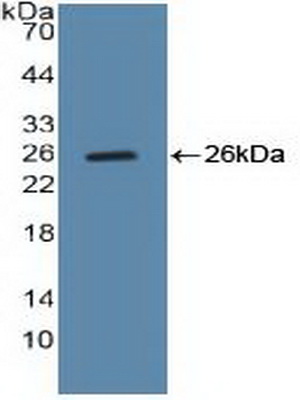 Polyclonal Antibody to Cyclin B (CCNB)