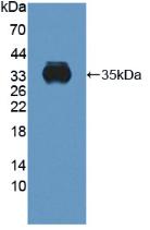 Polyclonal Antibody to Cytochrome b-245 Beta Polypeptide (CYBb)