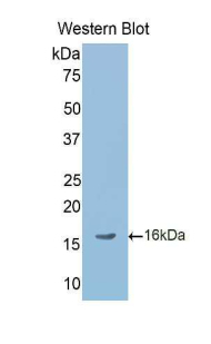 Polyclonal Antibody to Left/Right Determination Factor 2 (LEFTY2)