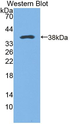 Polyclonal Antibody to Calcium/Calmodulin Dependent Protein Kinase II Beta (CAMK2b)