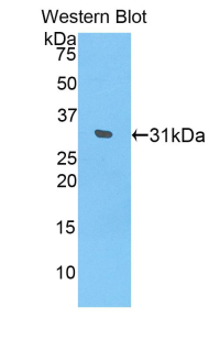 Polyclonal Antibody to Interleukin 17 Receptor D (IL17RD)