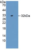 Polyclonal Antibody to Interleukin 17 Receptor D (IL17RD)