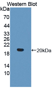 Polyclonal Antibody to Interleukin 17 Receptor B (IL17RB)