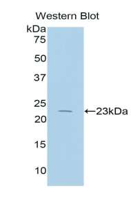 Polyclonal Antibody to Interleukin 17 Receptor B (IL17RB)