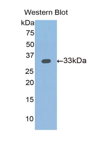 Polyclonal Antibody to Slit Homolog 1 (Slit1)