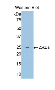 Polyclonal Antibody to Slit Homolog 1 (Slit1)