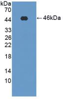 Polyclonal Antibody to Phosphofructokinase, Muscle (PFKM)