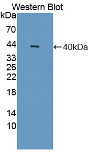 Polyclonal Antibody to Myosin Binding Protein C, Slow Type (MYBPC1)