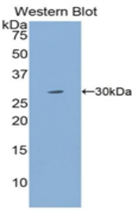 Polyclonal Antibody to Myosin Heavy Chain 4, Skeletal Muscle (MYH4)