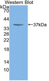 Polyclonal Antibody to Myosin Heavy Chain 6, Cardiac Muscle, Alpha (MYH6)