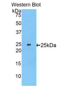 Polyclonal Antibody to Myosin Heavy Chain 8, Skeletal Muscle, Perinatal (MYH8)