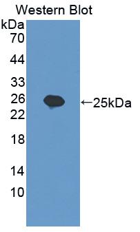 Polyclonal Antibody to Myosin Light Chain Kinase 2 (MYLK2)