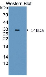 Polyclonal Antibody to Myosin Light Chain 6B, Alkali, Smooth Muscle And Non Muscle (MYL6B)