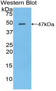 Polyclonal Antibody to Myosin Light Chain 6B, Alkali, Smooth Muscle And Non Muscle (MYL6B)