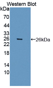 Polyclonal Antibody to Aryl Hydrocarbon Receptor Nuclear Translocator Like Protein (ARNTL)